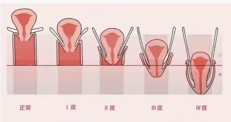 艾美涵一会多少钱 ,徒手女性私密哪家强